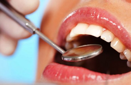 Новые зубные пломбы с неограниченным сроком службы