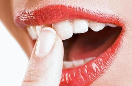 Расшатывание передних зубов: причины и профилактика